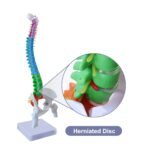 Anatomical Spine Model - الصورة 4